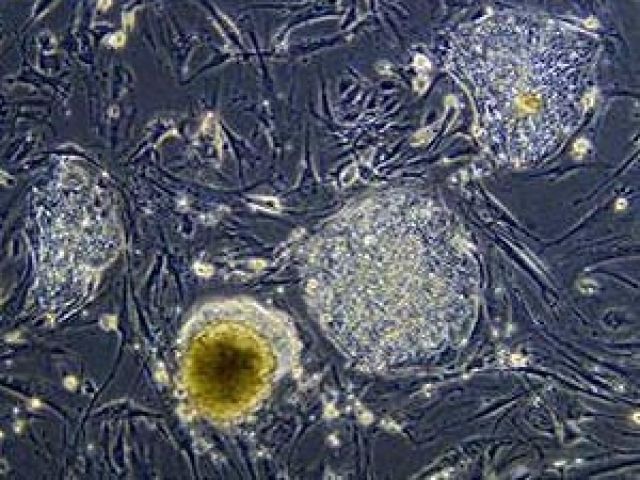 Đột phá trong nghiên cứu về